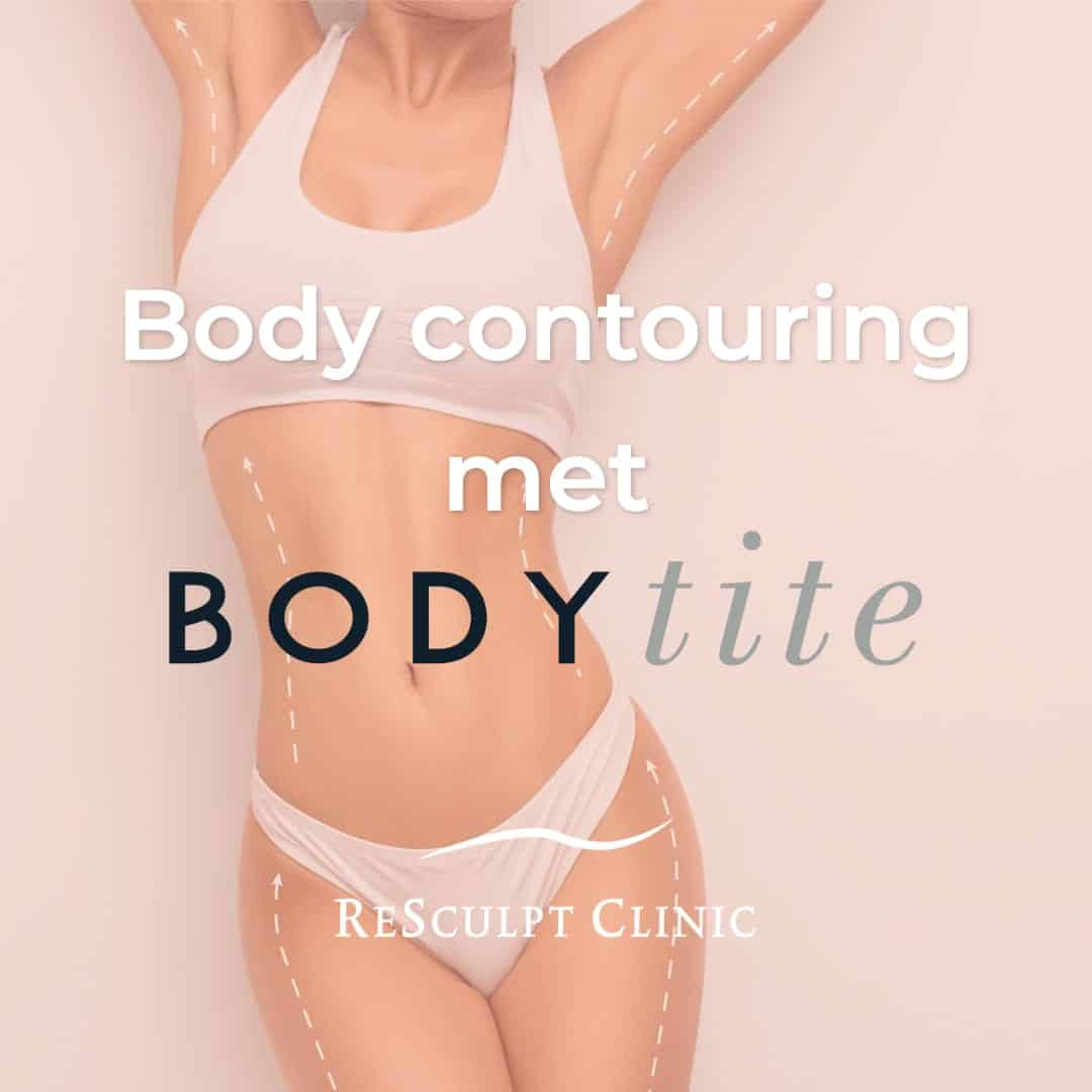 bodytite, body tite, bodytite behandeling, body contouring
