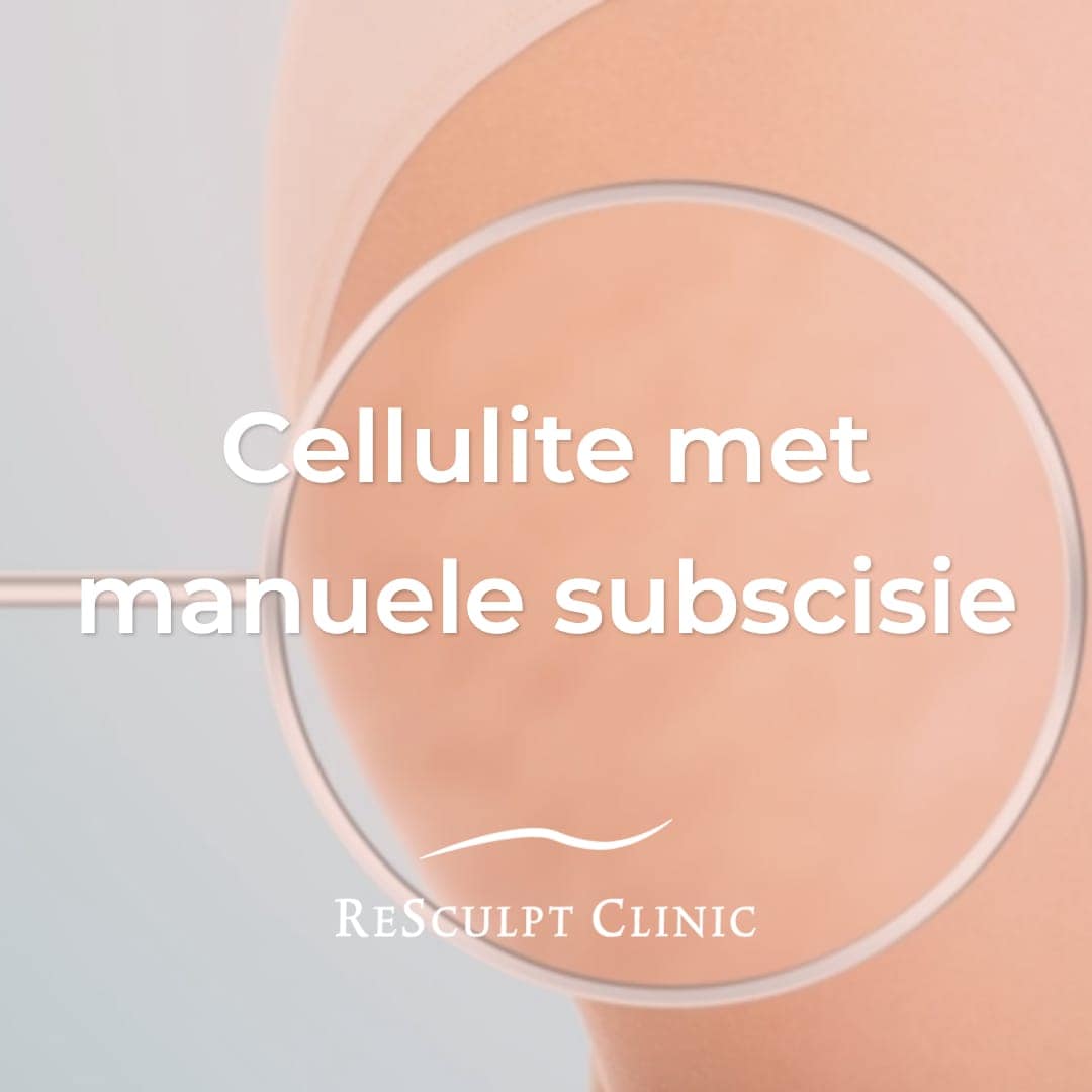 Cellulite met manuele subscisie, cellulite
