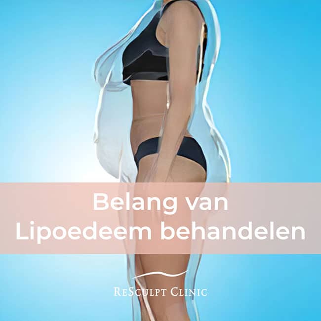 lipoedeem behandeling, lipoedeem oorzaak, lipoedeem oplossing, resculpt clinic