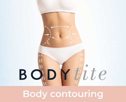 bodytite, body tite, bodytite behandeling, body contouring