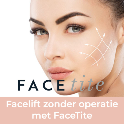 FaceTite, facetite behandeling, facelift zonder operatie, facelift, facelift zonder snijden