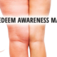 lipoedeem, lipoedeem awareness maand, lipoedeem behandelen, lipoedeem ervaring, ReSculpt Clinic