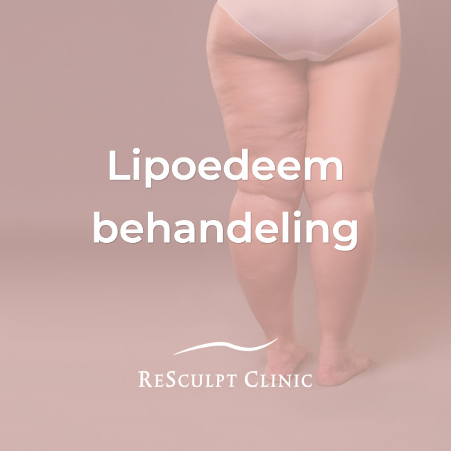 lipoedeem behandeling, lipoedeem dieet, lipoedeem, resculpt clinic