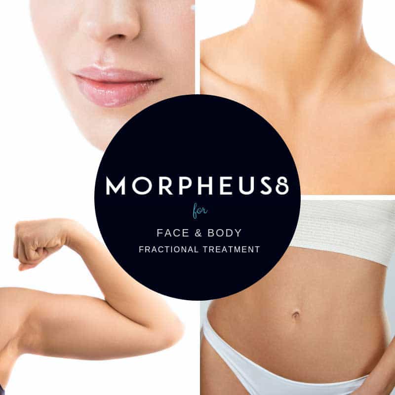 microneedling, microneedling treatment, morpheus8 treatment, micro needling, skin improvement