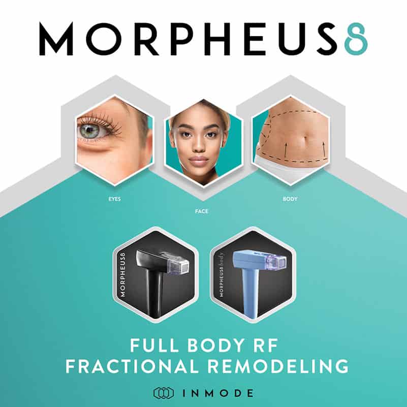 morpheus8, microneedling behandeling, huidverbetering, collageen, huidverstrakking