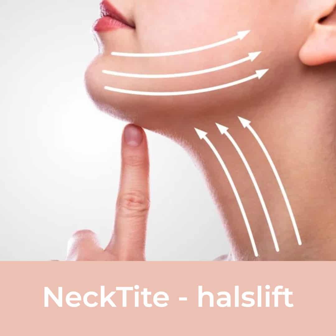 necktite, neck elevator without surgery, neck elevator, tightening jawline, neck elevator, resculpt clinic