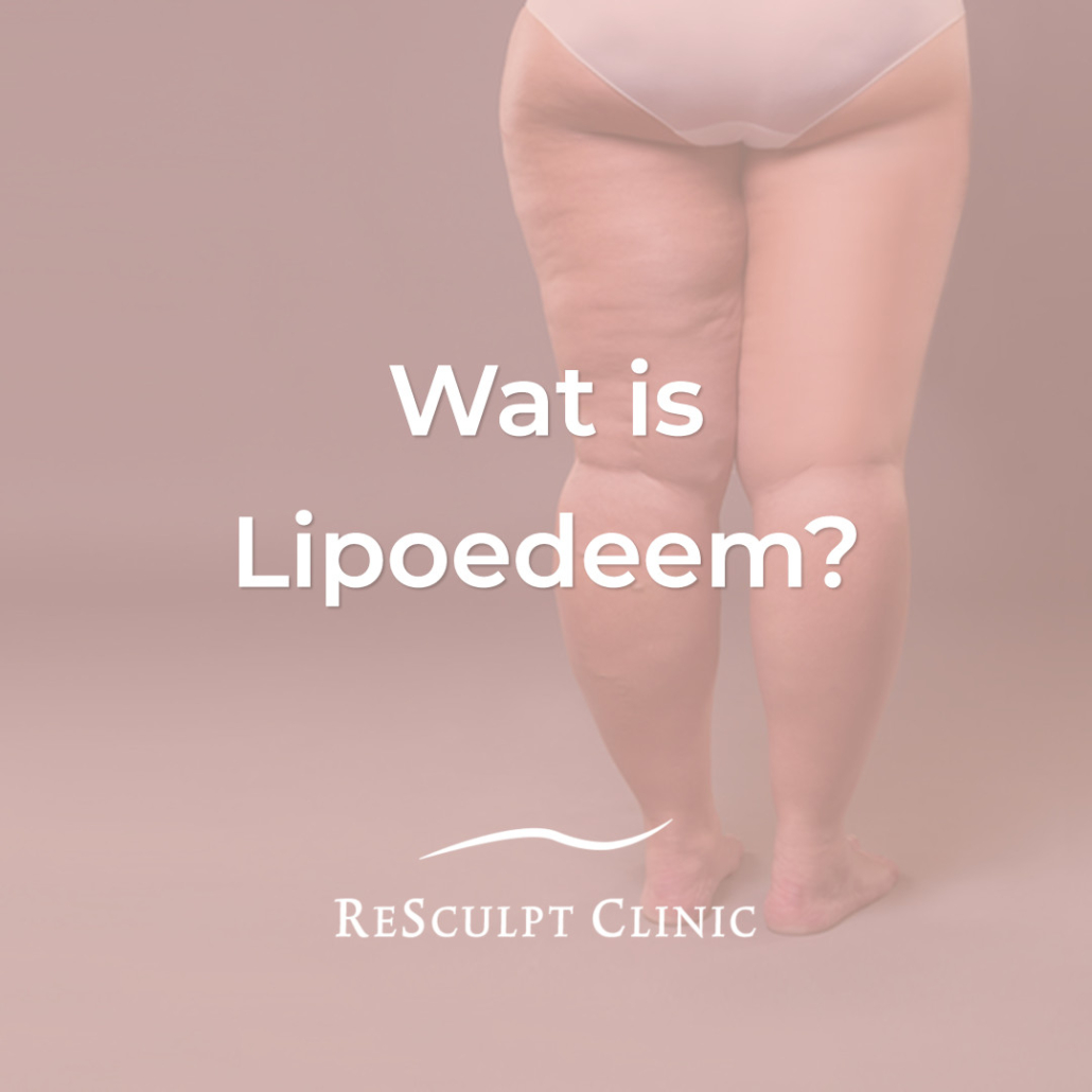 wat is lipoedeem, lipoedeem wat is dat, resculpt clinic,