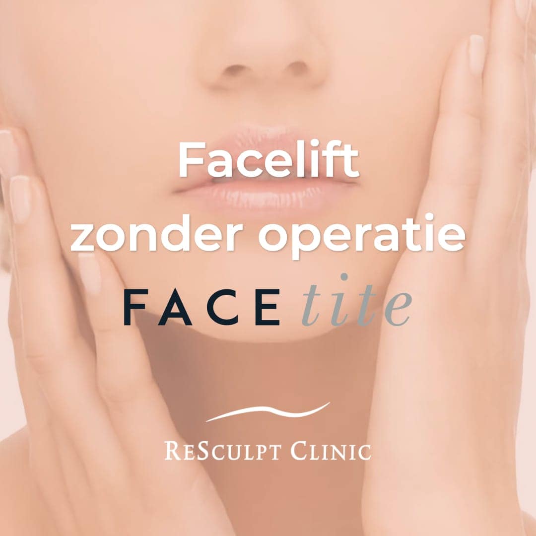 FaceTite, facetite behandeling, facelift zonder operatie, facelift, facelift zonder snijden