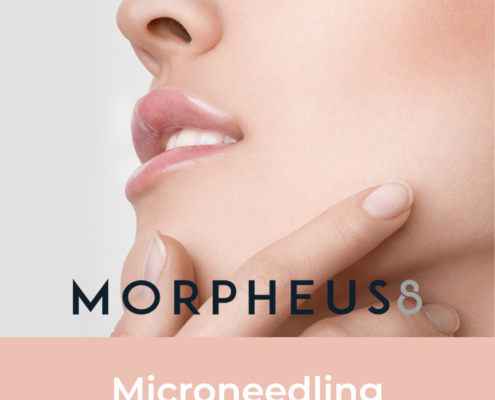 Morpheus8, microneedling, microneedlign behandeling, morpheus behandeling, huidverstrakking, huidverjonging, resculpt clinic