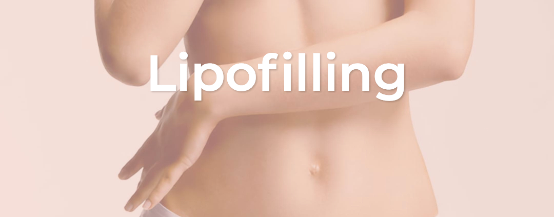 lipofilling, lipofilling behandeling, lipofill, lipofilling billen, resculpt clinic