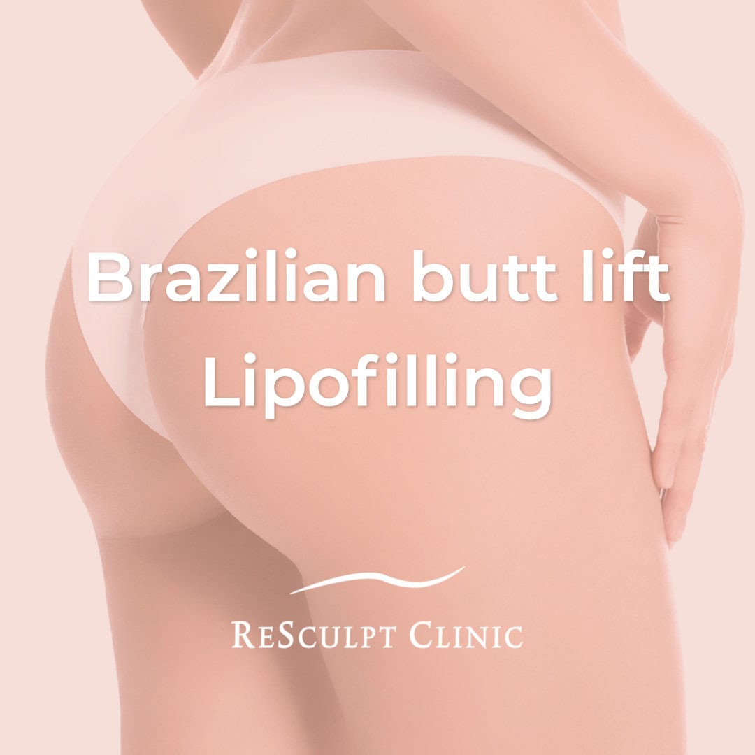 Brazilian butt lift, lipofilling, lipofilling behandeling, lipofill, lipofilling billen, resculpt clinic