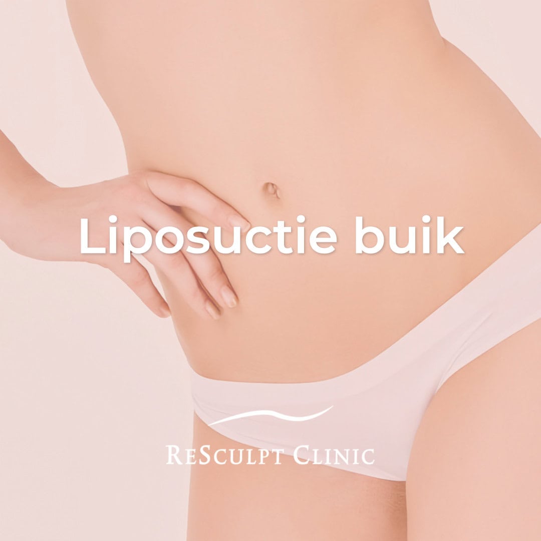 liposuctie buik, liposuctie buik behandeling,buikvet verwijderen, liposculpture buik, buikvet,