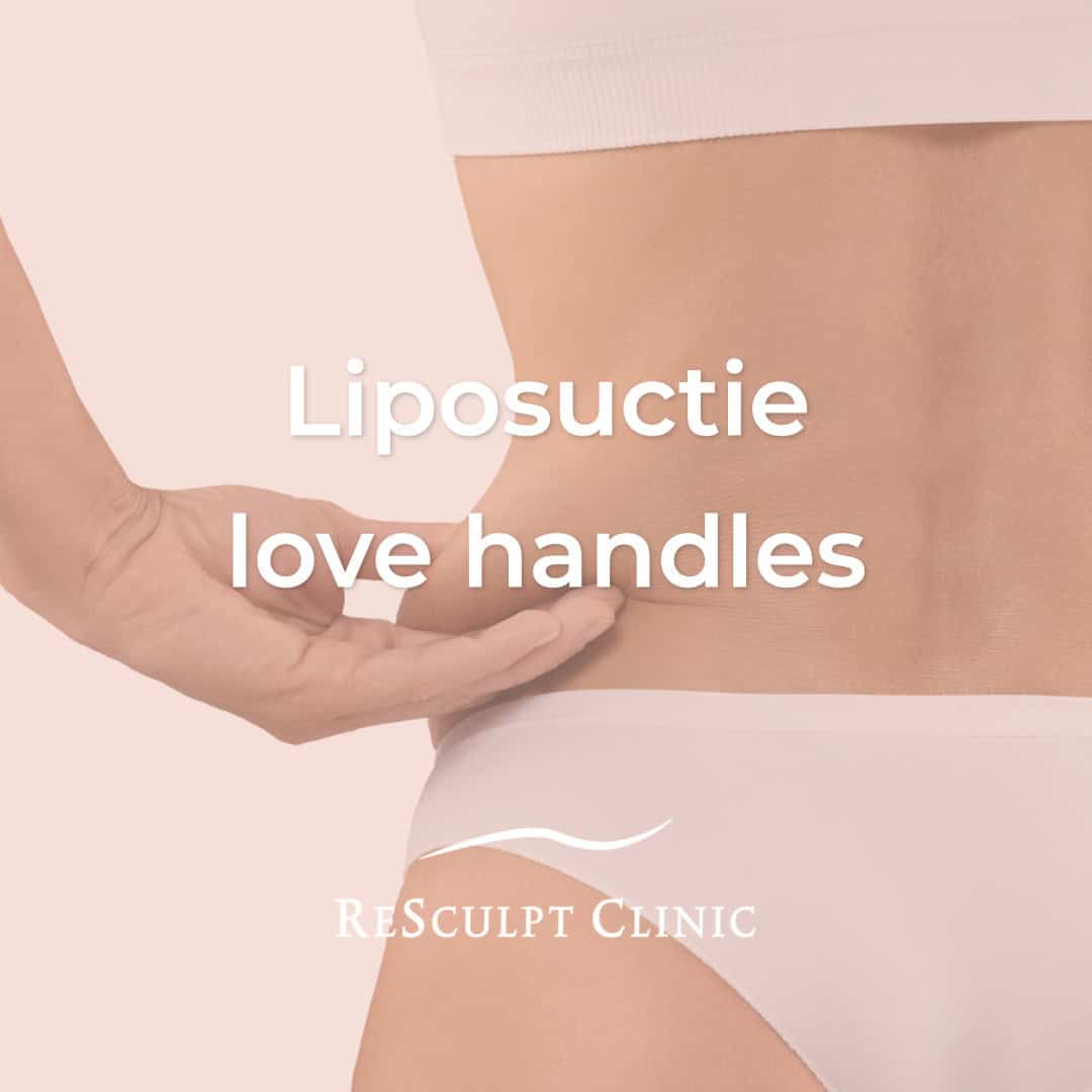 liposcutie love handles, liposuctie middel, vet verwijderen taille