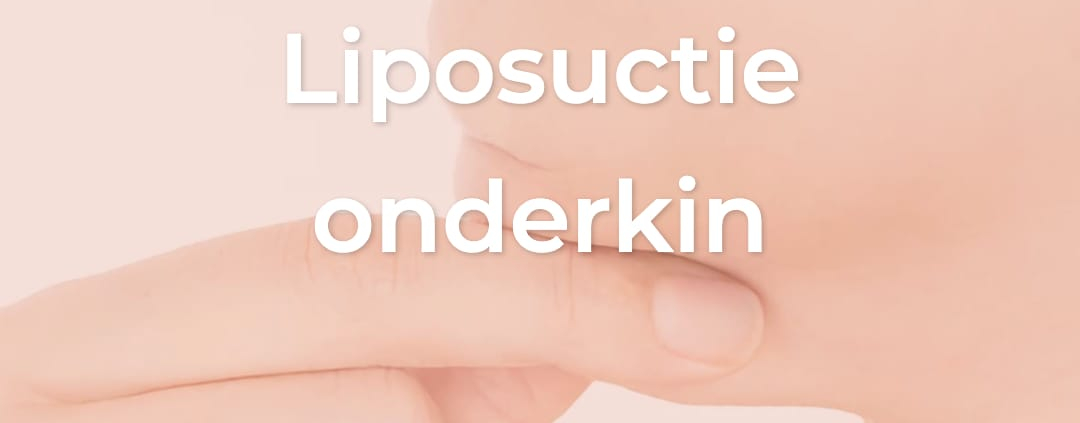 Double chin liposuction, neck elevator without surgery, double chin removal, facelift, resculpt clinic