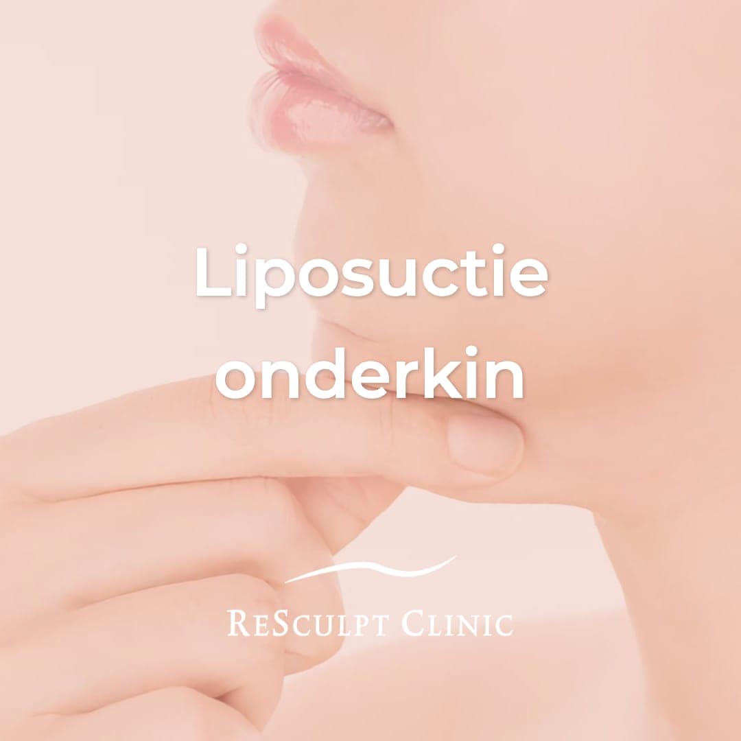 Liposuctie onderkin, halslift zonder operatie, onderkin verwijderen, facelift, resculpt clinic