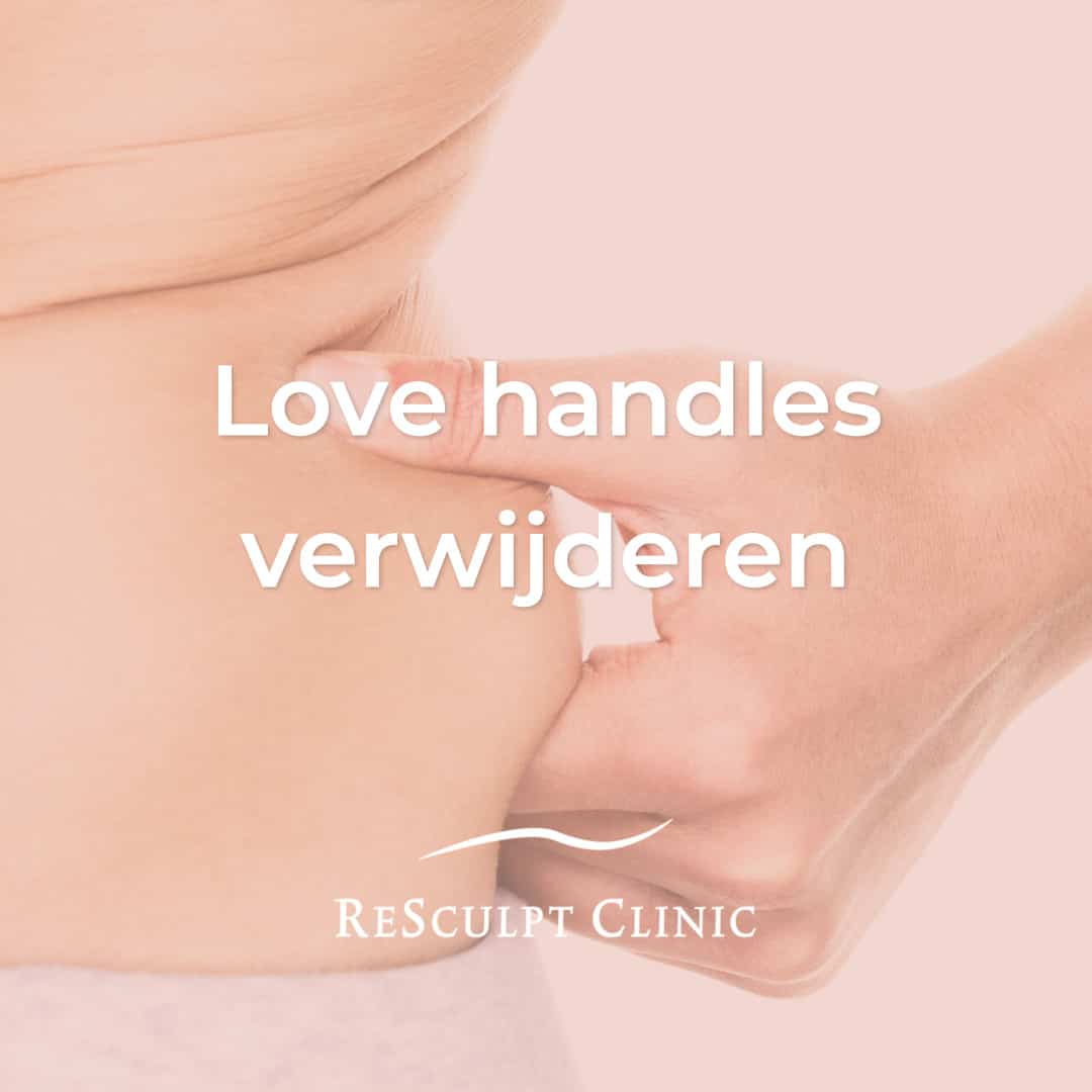 love handles, love handles verwijderen, love handles wegwerken, liposuctie lovehandles