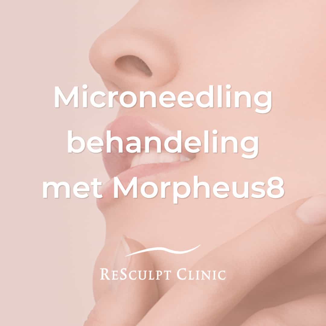 microneedling behandeling, microneedling voor en na, m icroneedling ervaringen