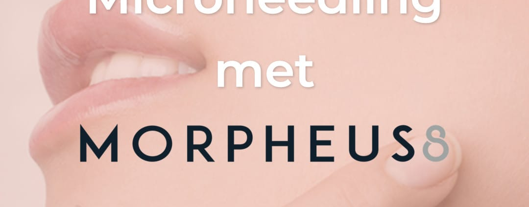 mirconeedling voor en na, Morpheus8 voor na, microneedling ervaringen, microneedling rescultaten, morpheus behandeling, huidverstrakking, huidverjonging, resculpt clinic
