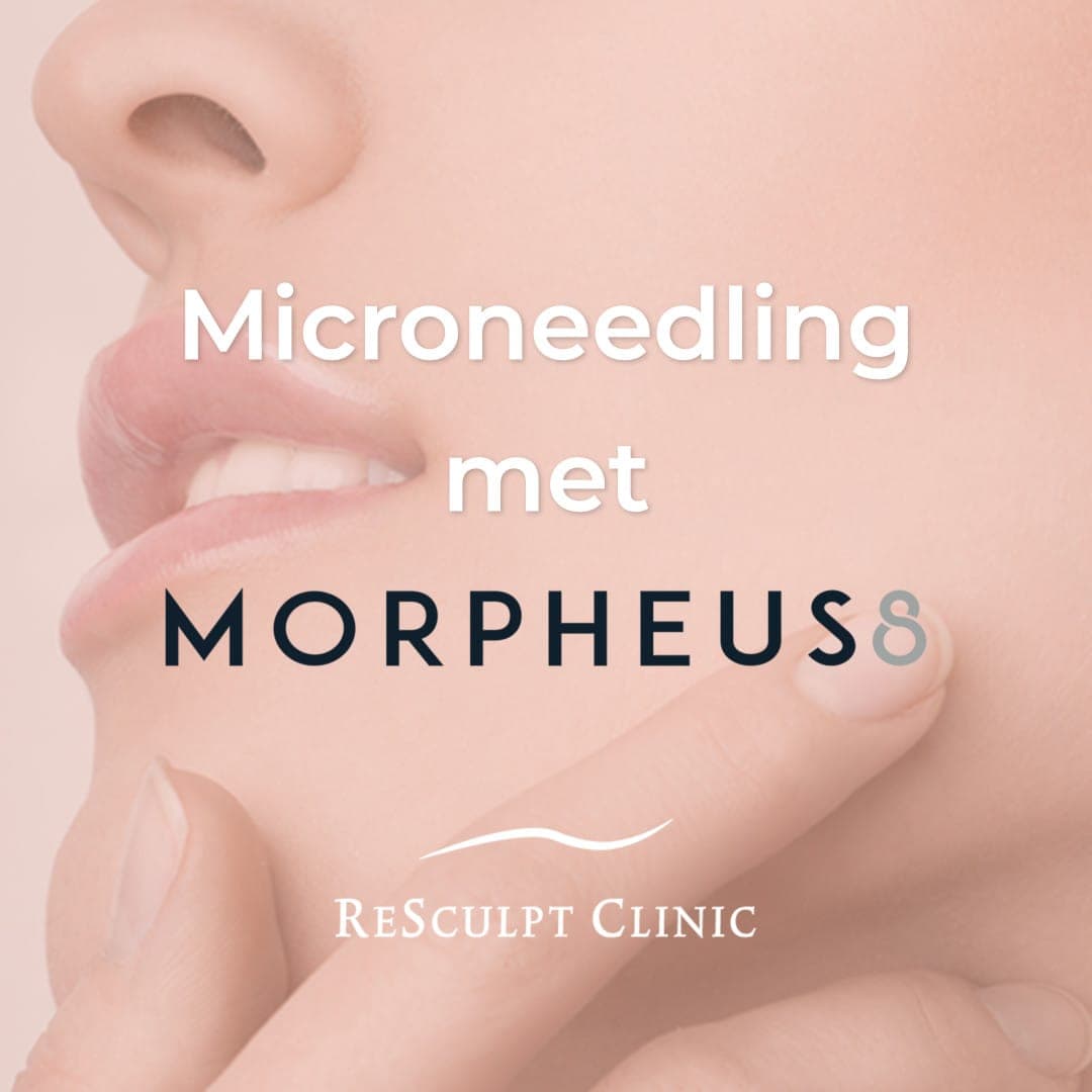 Morpheus8, microneedling, microneedlign behandeling, morpheus behandeling, huidverstrakking, huidverjonging, resculpt clinic