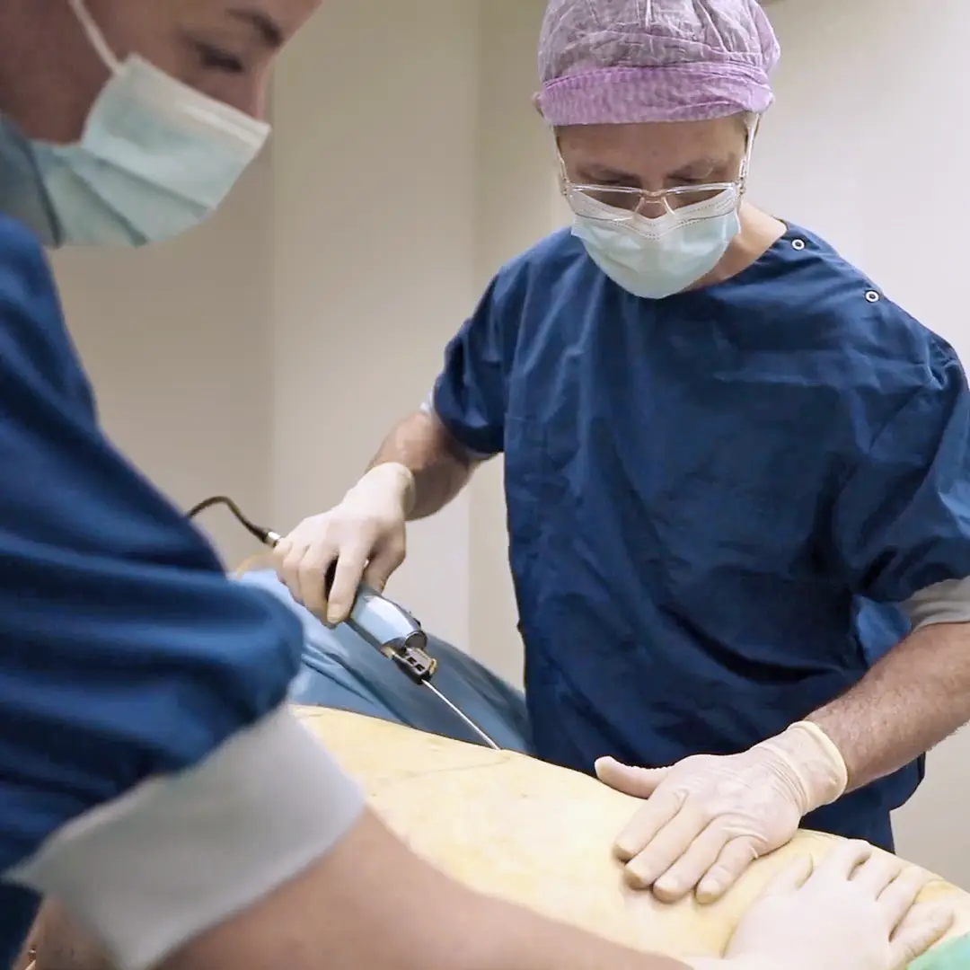 Lipoedeem, Liposuctie, Drs. Hajo Bruining, amsterdam, resculpt clinic